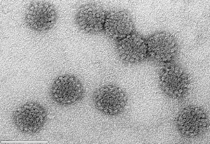 Papilloma virus L1 capsid proteins